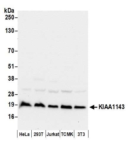 KIAA1143 Antibody (aa104-154)