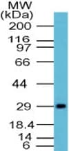 Influenza A Virus N1 Antibody (aa238-253)