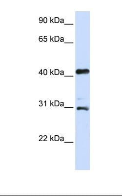 Polyclonal Rabbit anti-Human AURKA / Aurora-A Antibody (C-Terminus, IHC, WB)