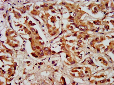 LAMC2 / Laminin Gamma 2 Antibody