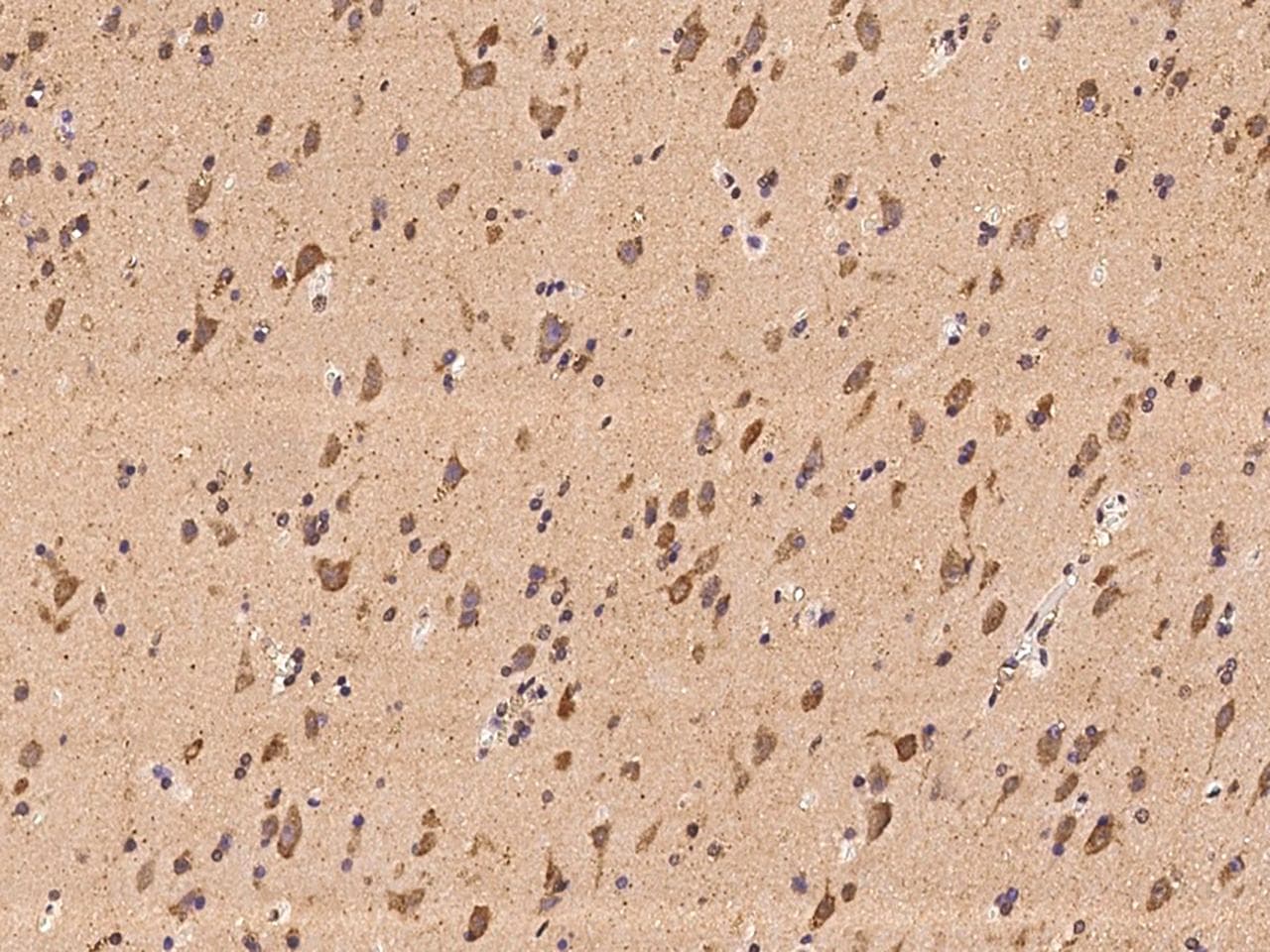 C1QDC1 / Caprin-2 Antibody