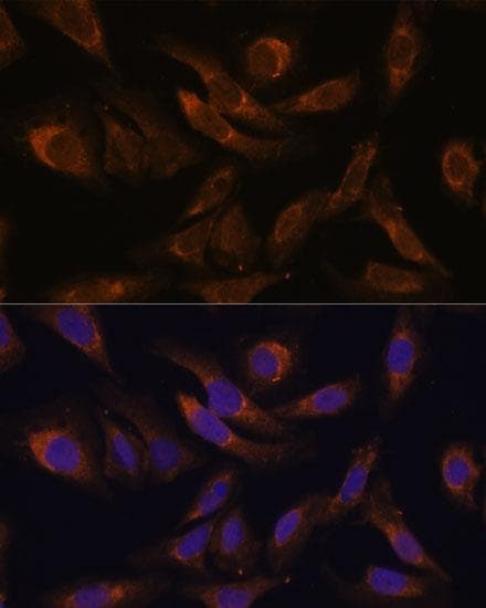 SOCS2 Antibody