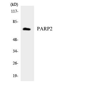 Polyclonal Rabbit anti-Human PARP2 Antibody (aa130-179, WB)
