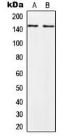 IHC-plus™ Polyclonal Rabbit anti-Human PALLD / Palladin Antibody (Internal, IHC, WB)