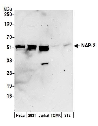Polyclonal Rabbit anti-Human NAP1L4 Antibody (aa325-375, WB)