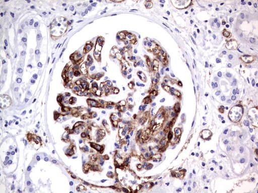 MCAM / CD146 Antibody (clone UMAB154)