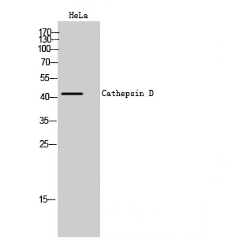 CTSD / Cathepsin D Antibody (Internal)