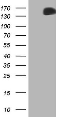 Monoclonal Mouse anti-Human c-Met Antibody (clone OTI3G5, aa570-885, WB)