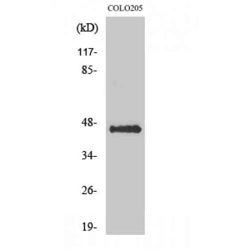 AVPR1B Antibody (250-330 aa, Internal)