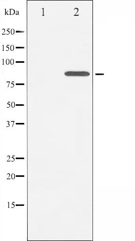 CTTN / Cortactin Antibody (phospho-Tyr421)