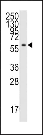 YARS / Tyrosyl-tRNA Synthetase Antibody (aa450-479)
