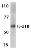 Polyclonal Rabbit anti-Human IL21 Receptor Antibody (IF, WB)