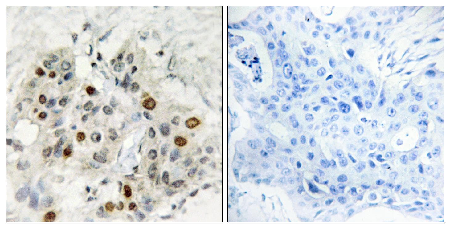 AFF1 / AF4 Antibody