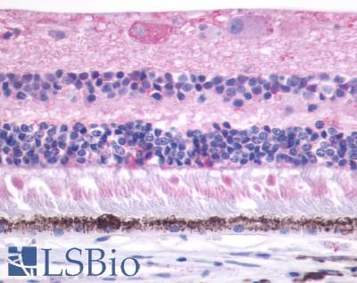 PathPlus™ MTNR1B / MT2 Antibody (Cytoplasmic Domain)