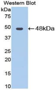 ENO3 / Enolase 3 Antibody (aa3-434)