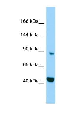 Polyclonal Rabbit anti-Human MICAL2 Antibody (aa630-679, WB)