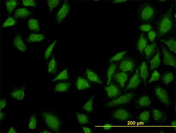 MTAP Antibody (clone 2G4)