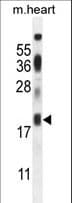 ISA2 / ISCA2 Antibody (aa72-101)