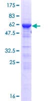 Human SRSF5 / SFRS5 Protein (Recombinant GST)