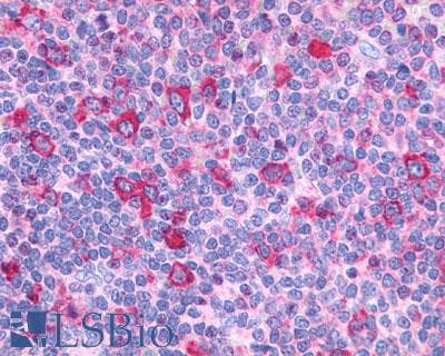 PathPlus™ GPR132 / G2A Antibody (Cytoplasmic Domain)