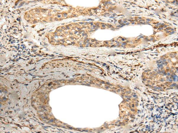 ZNF8 Antibody