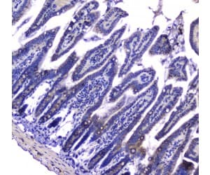 Polyclonal Rabbit anti-Human MAC-2-BP / LGALS3BP Antibody (IHC, WB)