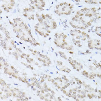 SIRT1 / Sirtuin 1 Antibody