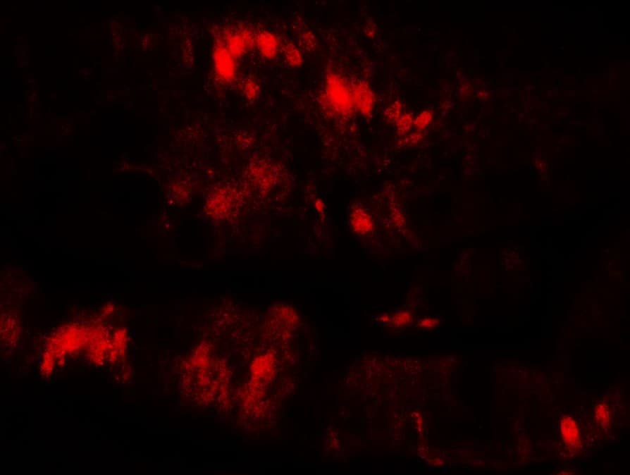 IHC-plus™ SLC29A3 / ENT3 Antibody