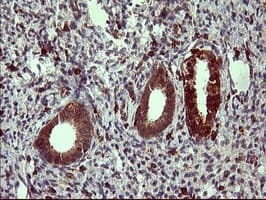 TP73 / p73 Antibody (aa167-409, clone OTI2D2)