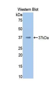F2 / Prothrombin / Thrombin Antibody (aa325-618, Biotin)