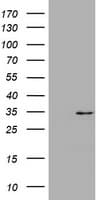 ABCB1 / MDR1 / P Glycoprotein Antibody (clone OTI5D1)