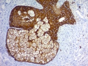 Pan Cytokeratin Antibody (clone PAN-CK (Cocktail))