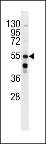 ADRB2 Antibody (Ser261)