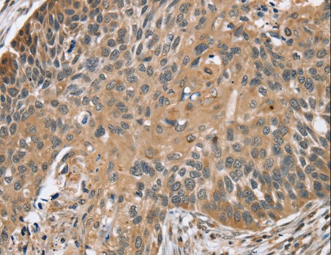 TRIM3 Antibody