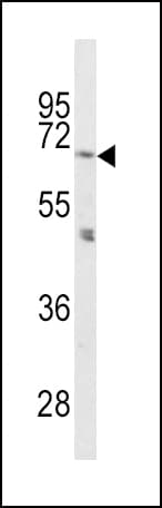 PCSK2 Antibody (aa87-116)