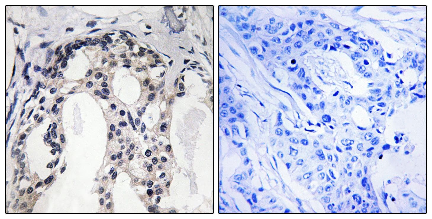NF2 / Merlin Antibody (phospho-Ser10)