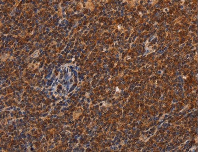 CDC34 Antibody