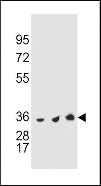 TS / Thymidylate Synthase Antibody (aa265-294)