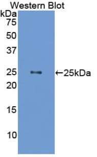 GH / Growth Hormone Antibody (aa28-216)