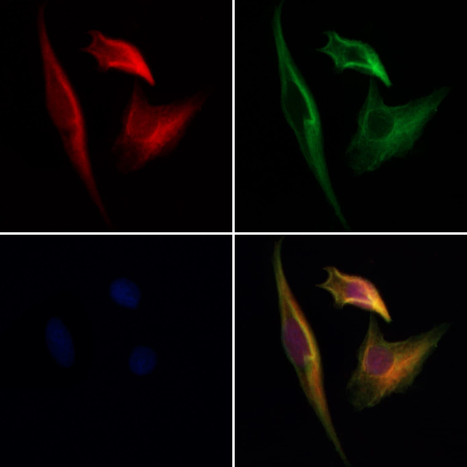 Polyclonal Rabbit anti-Human CPNE6 / N-COPINE Antibody (IF, WB)