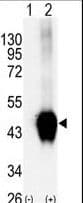 BCKDK Antibody (aa325-356)