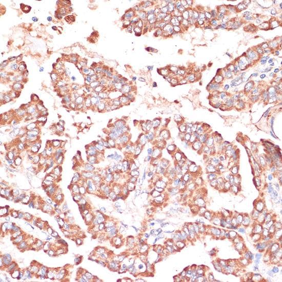 Polyclonal Rabbit anti-Human FRMD6 Antibody (IHC, IF)