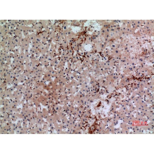 GP1BA / CD42b Antibody (261-310 aa, Internal)