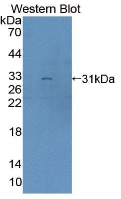 BCOR Antibody (aa1553-1755)