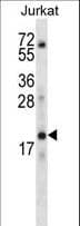 KRTAP1-3 Antibody (aa108-135)