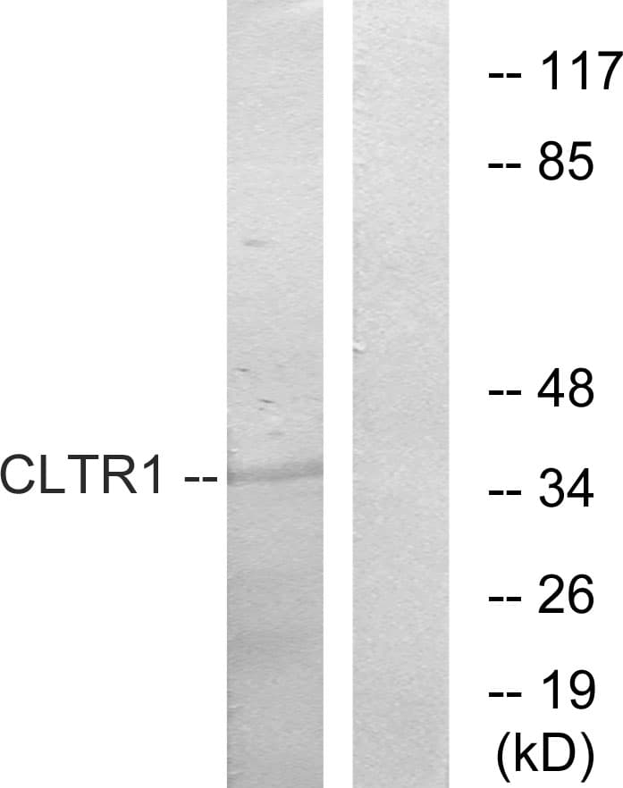 IHC-plus™ CYSLTR1 / CYSLT1 Antibody (aa131-180)
