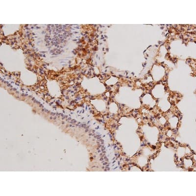 Polyclonal Rabbit anti-Human c-Kit / CD117 Antibody (IHC, IF, WB)