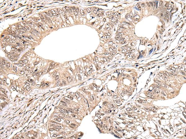 MAP1D Antibody