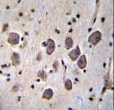 Polyclonal Rabbit anti-Human ANKRD34C Antibody (aa384-412, IHC, WB)