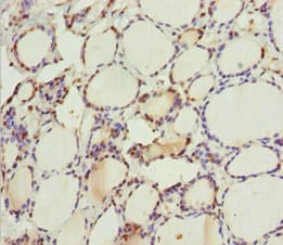 Polyclonal Rabbit anti-Human MTUS1 Antibody (IHC)